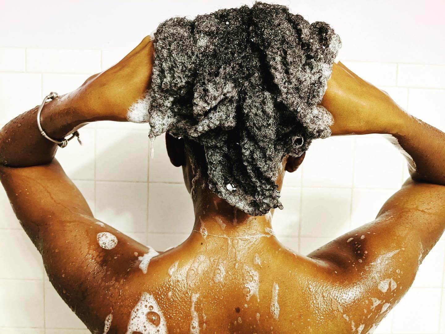 Dry Scalp Treatments for Natural Hair
